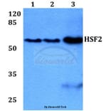 Anti-HSF2 (R432) Antibody from Bioworld Technology (BS2033) - Antibodies.com