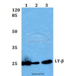 Anti-LT-β (V211) Antibody from Bioworld Technology (BS2038) - Antibodies.com