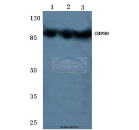 Anti-CBP80 (R5) Antibody from Bioworld Technology (BS2040) - Antibodies.com
