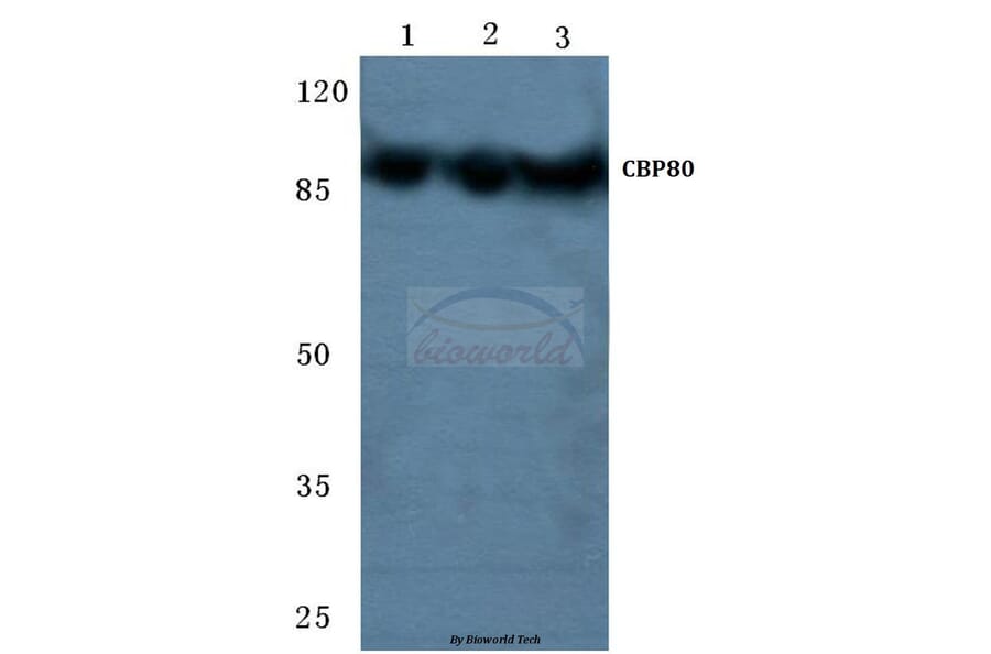 Anti-CBP80 (R5) Antibody from Bioworld Technology (BS2040) - Antibodies.com