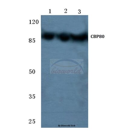 Anti-CBP80 (R5) Antibody from Bioworld Technology (BS2040) - Antibodies.com