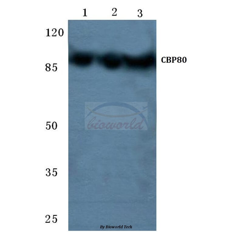 Anti-CBP80 (R5) Antibody from Bioworld Technology (BS2040) - Antibodies.com