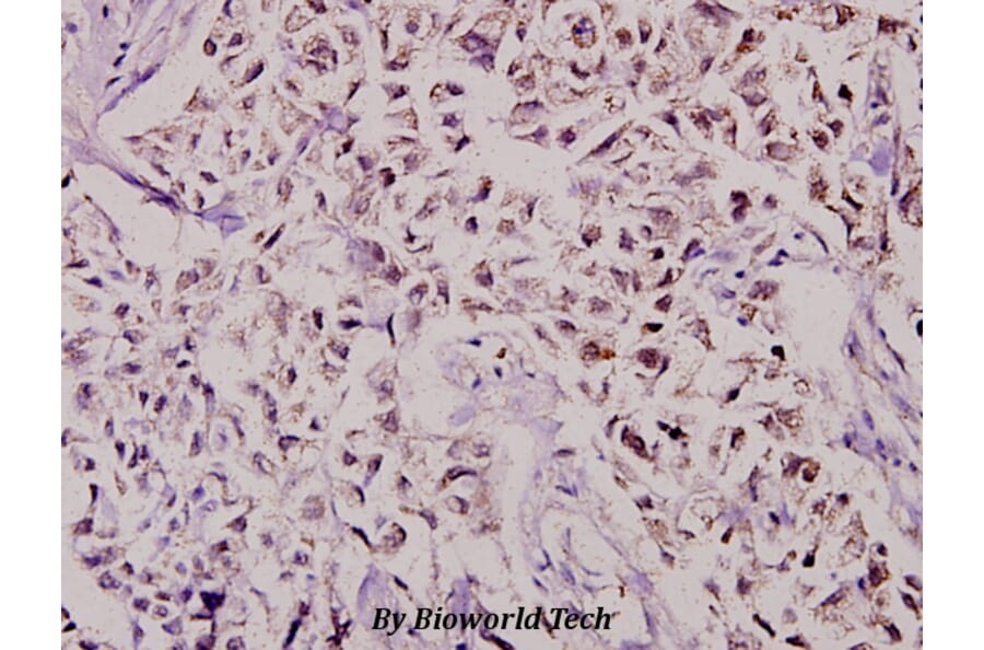 Anti-CBP80 (R5) Antibody from Bioworld Technology (BS2040) - Antibodies.com