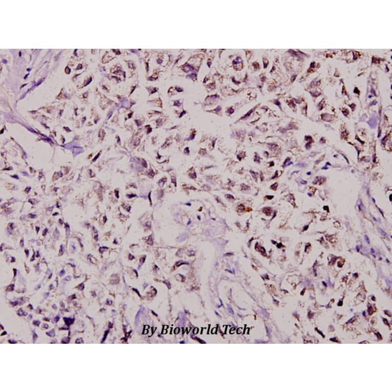 Anti-CBP80 (R5) Antibody from Bioworld Technology (BS2040) - Antibodies.com
