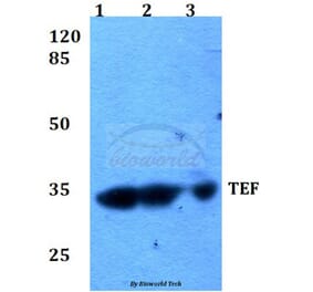 Anti-TEF (K224) Antibody from Bioworld Technology (BS2041) - Antibodies.com