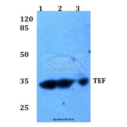 Anti-TEF (K224) Antibody from Bioworld Technology (BS2041) - Antibodies.com