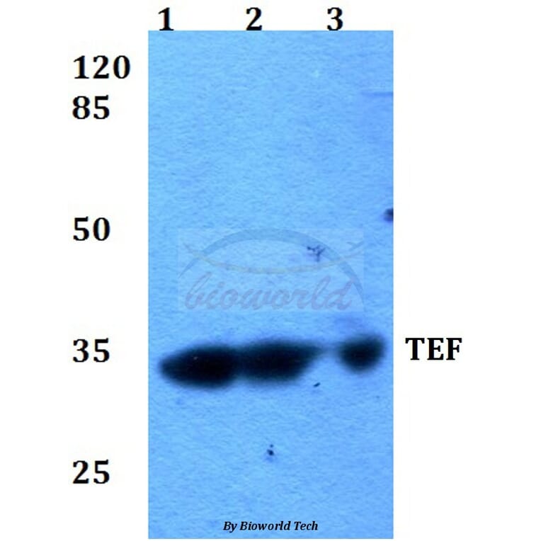 Anti-TEF (K224) Antibody from Bioworld Technology (BS2041) - Antibodies.com