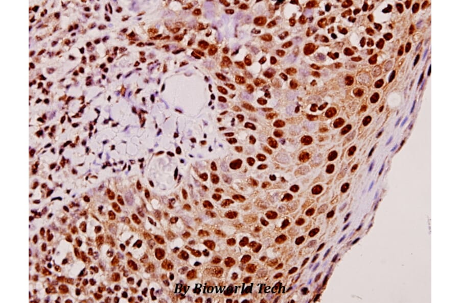 Anti-TEF (K224) Antibody from Bioworld Technology (BS2041) - Antibodies.com