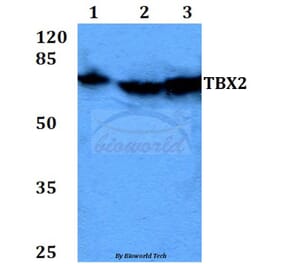 Anti-TBX2 (N280) Antibody from Bioworld Technology (BS2043) - Antibodies.com