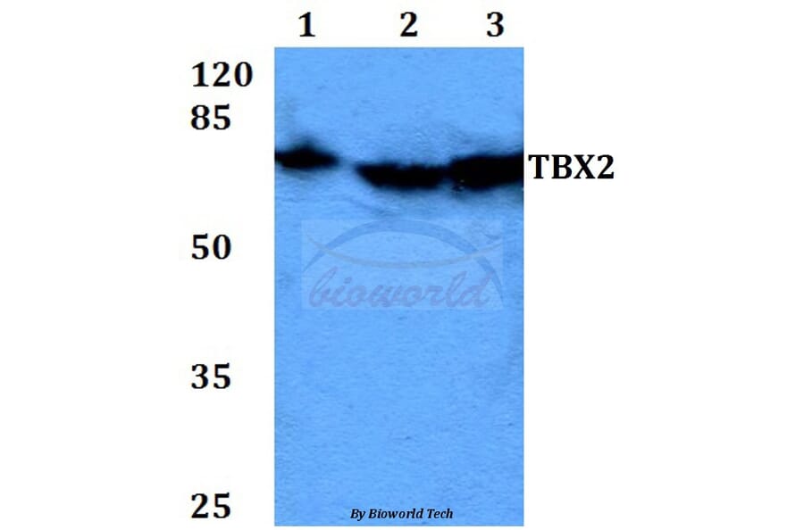 Anti-TBX2 (N280) Antibody from Bioworld Technology (BS2043) - Antibodies.com