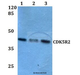 Anti-CDK5R2 (N100) Antibody from Bioworld Technology (BS2044) - Antibodies.com