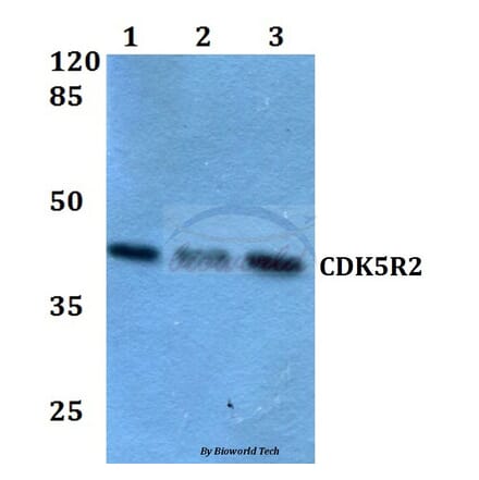 Anti-CDK5R2 (N100) Antibody from Bioworld Technology (BS2044) - Antibodies.com