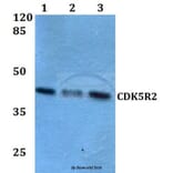 Anti-CDK5R2 (N100) Antibody from Bioworld Technology (BS2044) - Antibodies.com