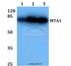 Anti-MTA1 (K182) Antibody from Bioworld Technology (BS2045) - Antibodies.com