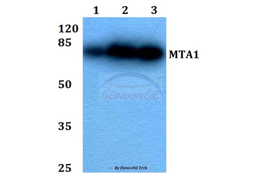 Anti-MTA1 (K182) Antibody from Bioworld Technology (BS2045) - Antibodies.com