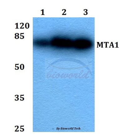 Anti-MTA1 (K182) Antibody from Bioworld Technology (BS2045) - Antibodies.com