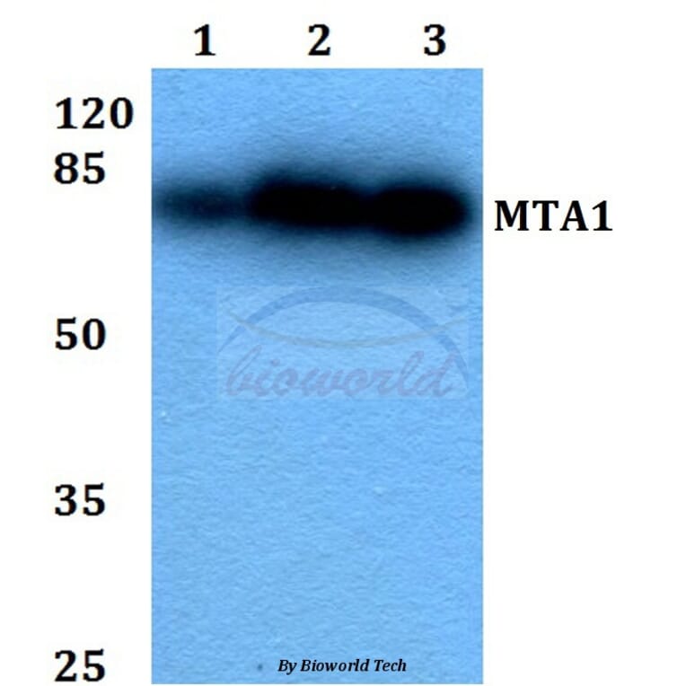 Anti-MTA1 (K182) Antibody from Bioworld Technology (BS2045) - Antibodies.com