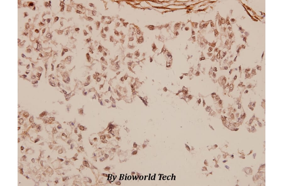 Anti-MTA1 (K182) Antibody from Bioworld Technology (BS2045) - Antibodies.com