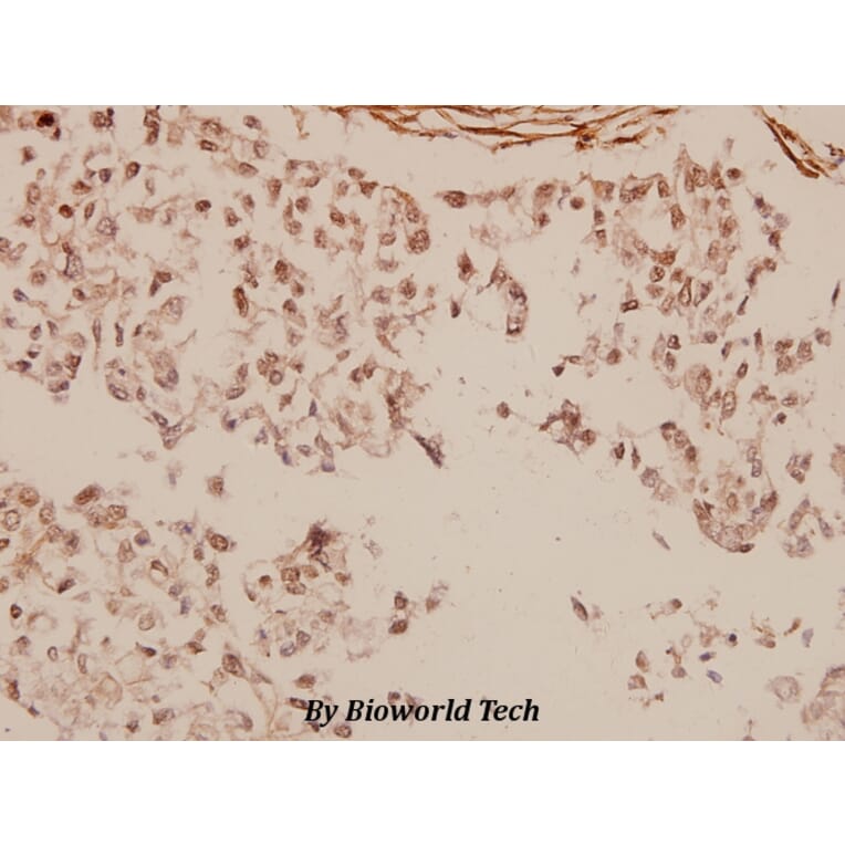 Anti-MTA1 (K182) Antibody from Bioworld Technology (BS2045) - Antibodies.com