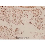 Anti-MTA1 (K182) Antibody from Bioworld Technology (BS2045) - Antibodies.com