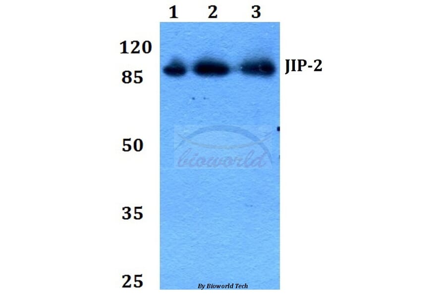 Anti-JIP-2 (N601) Antibody from Bioworld Technology (BS2046) - Antibodies.com