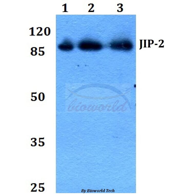 Anti-JIP-2 (N601) Antibody from Bioworld Technology (BS2046) - Antibodies.com
