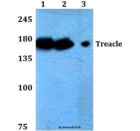 Anti-Treacle (Q55) Antibody from Bioworld Technology (BS2047) - Antibodies.com