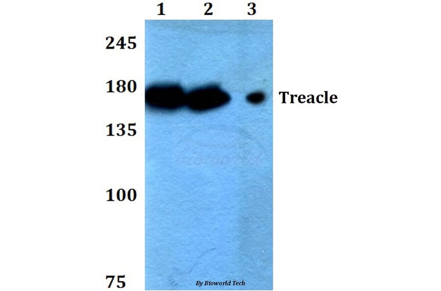 Anti-Treacle (Q55) Antibody from Bioworld Technology (BS2047) - Antibodies.com