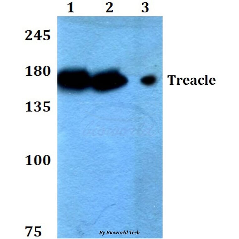 Anti-Treacle (Q55) Antibody from Bioworld Technology (BS2047) - Antibodies.com