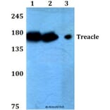 Anti-Treacle (Q55) Antibody from Bioworld Technology (BS2047) - Antibodies.com