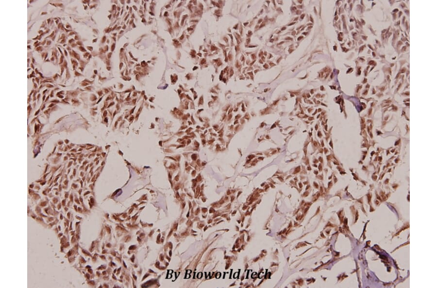 Anti-Treacle (Q55) Antibody from Bioworld Technology (BS2047) - Antibodies.com