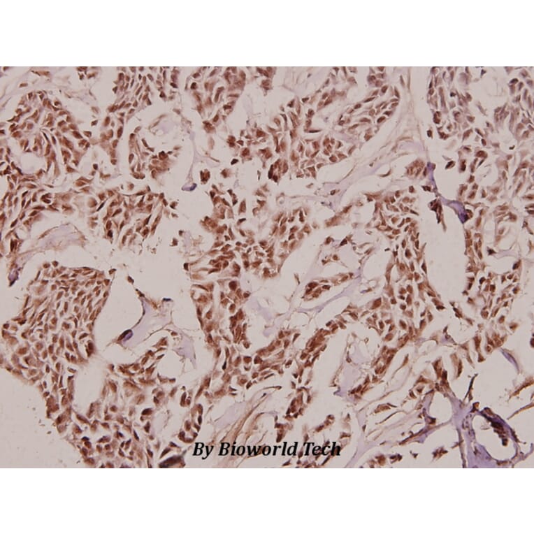 Anti-Treacle (Q55) Antibody from Bioworld Technology (BS2047) - Antibodies.com