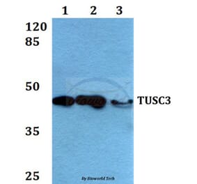 Anti-TUSC3 (H153) Antibody from Bioworld Technology (BS2048) - Antibodies.com