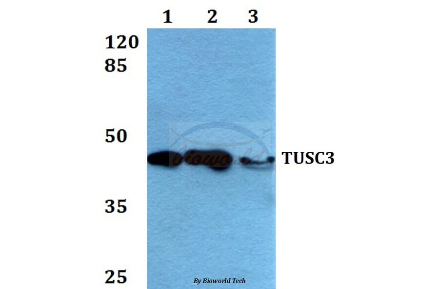 Anti-TUSC3 (H153) Antibody from Bioworld Technology (BS2048) - Antibodies.com