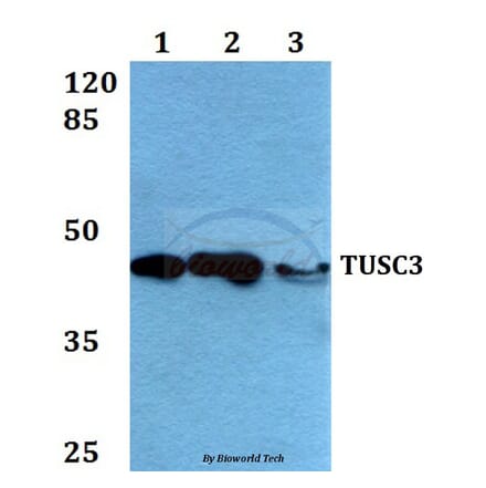 Anti-TUSC3 (H153) Antibody from Bioworld Technology (BS2048) - Antibodies.com