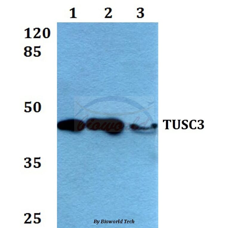 Anti-TUSC3 (H153) Antibody from Bioworld Technology (BS2048) - Antibodies.com