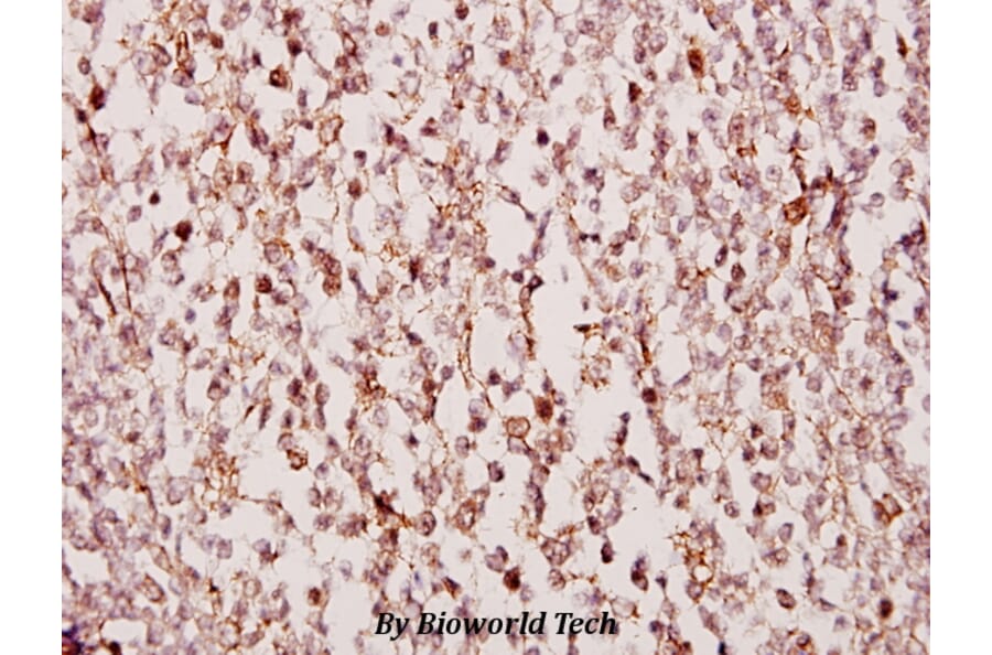 Anti-TUSC3 (H153) Antibody from Bioworld Technology (BS2048) - Antibodies.com