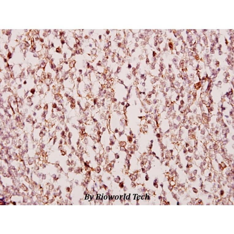 Anti-TUSC3 (H153) Antibody from Bioworld Technology (BS2048) - Antibodies.com