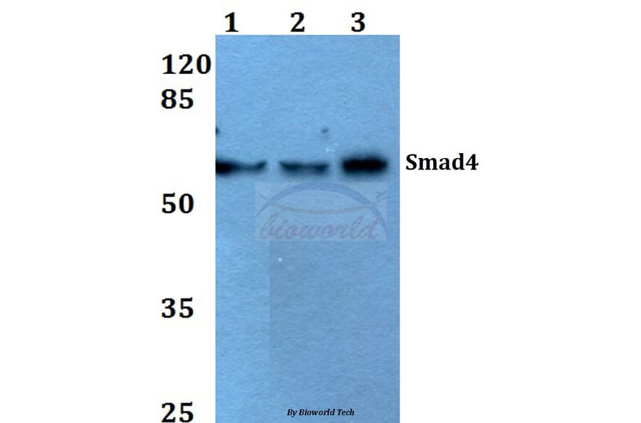 Anti-Smad4 (L43) Antibody from Bioworld Technology (BS2050) - Antibodies.com