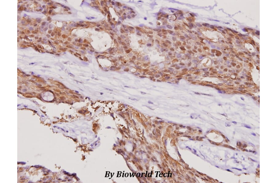 Anti-Smad4 (L43) Antibody from Bioworld Technology (BS2050) - Antibodies.com
