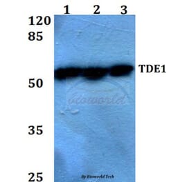 Anti-TDE1 (R392) Antibody from Bioworld Technology (BS2051) - Antibodies.com