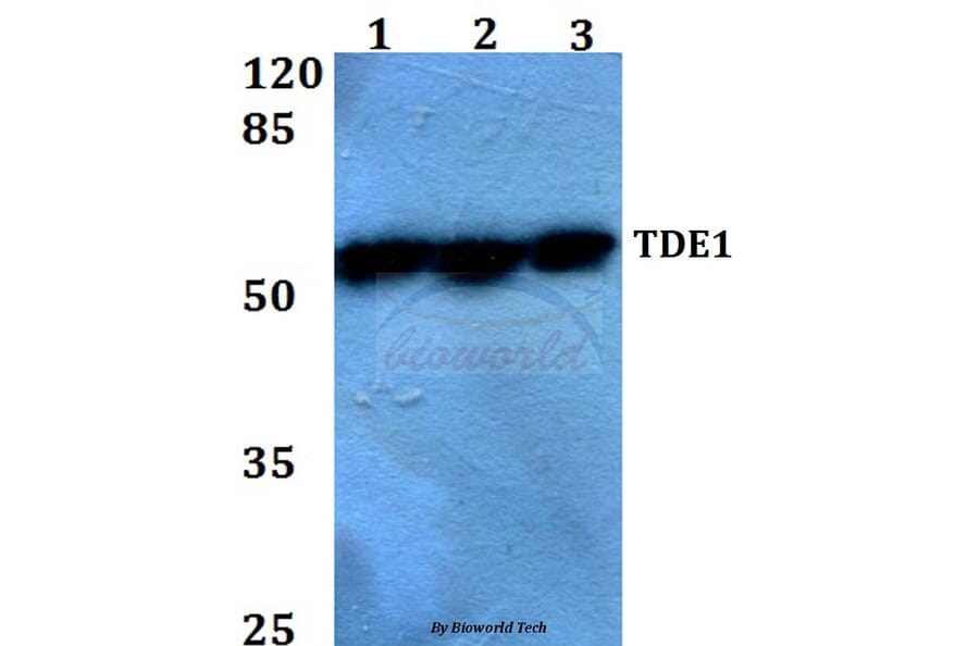 Anti-TDE1 (R392) Antibody from Bioworld Technology (BS2051) - Antibodies.com