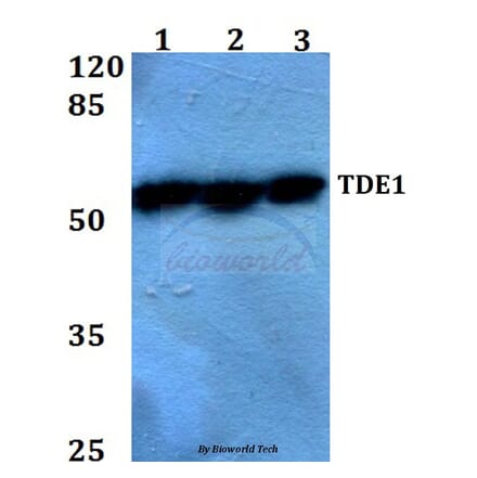 Anti-TDE1 (R392) Antibody from Bioworld Technology (BS2051) - Antibodies.com