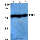 Anti-TDE1 (R392) Antibody from Bioworld Technology (BS2051) - Antibodies.com