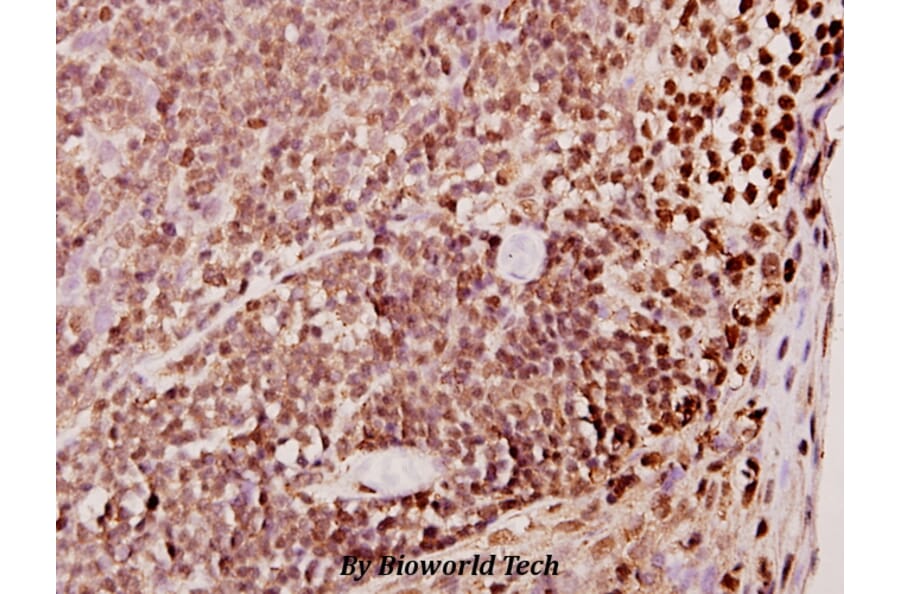 Anti-TDE1 (R392) Antibody from Bioworld Technology (BS2051) - Antibodies.com