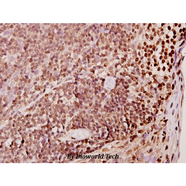 Anti-TDE1 (R392) Antibody from Bioworld Technology (BS2051) - Antibodies.com