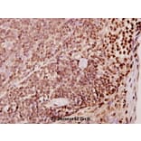 Anti-TDE1 (R392) Antibody from Bioworld Technology (BS2051) - Antibodies.com