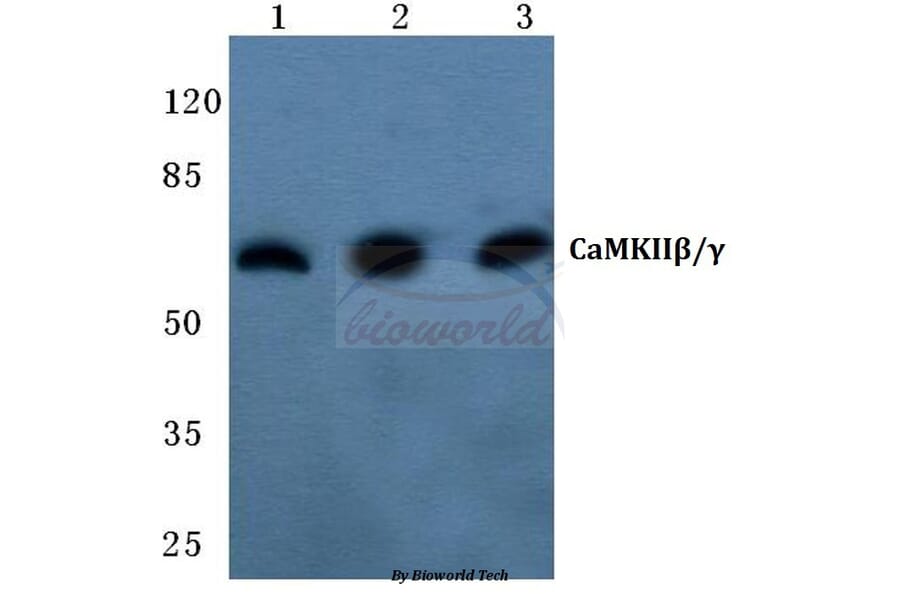 Anti-CaMKIIβ/γ (R631) Antibody from Bioworld Technology (BS2052) - Antibodies.com