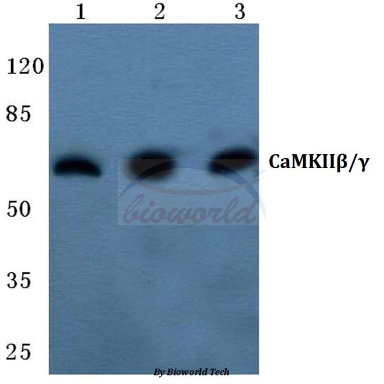 Anti-CaMKIIβ/γ (R631) Antibody from Bioworld Technology (BS2052) - Antibodies.com