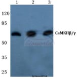 Anti-CaMKIIβ/γ (R631) Antibody from Bioworld Technology (BS2052) - Antibodies.com